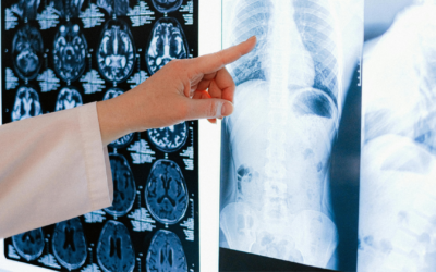 The AI Revolution in Radiology